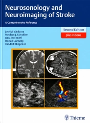 Buchcover Neurosonology and Neuroimaging of Stroke